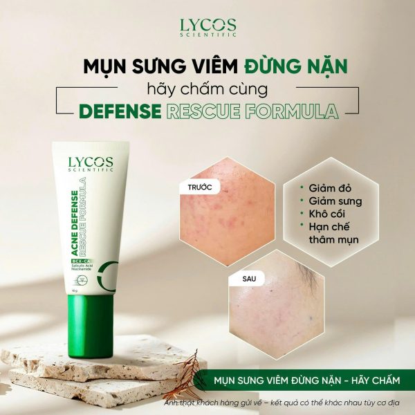 Chấm Mụn LYCOS Acne Defense Rescue Formula Hỗ Trợ Làm Khô Cồi, Làm Dịu, Giảm Thâm 10g - Ảnh 2